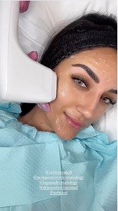 Take a look at Youngcouture_ Sofwave™ journey! 🌊 Sofwave™ uses groundbreaking ultrasound technology to reduce the appearance of fine lines and wrinkles, give skin a natural LIFT, boost production of collagen, elastin, and hyaluronic acid that produce SUPERB™ results. Youngcouture_ Newport Cove Dermatology Laguna Dermatology Jennifer Channual #Sofwave #UltrasoundTechnology #SUPERBResults | Sofwave