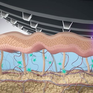 Opus, da Alma, tem uma tecnologia patenteada - a energia RF converte...
