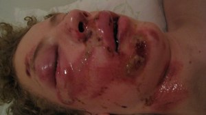 blood and throw ups.