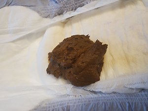 Open diaper poop - video 4