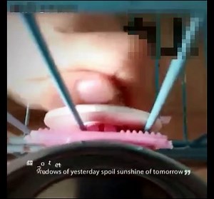 Joyoldelf Dog Bowl Feeder Pet Puppy Food Water Bowl, 2-in-1 Plastic Bowl & Stainless Steel Bowl, Mountable Cat/Rabbit/Bird/Hamster/Shitzu/Ferret Food Basin Dish Perfect for Crates