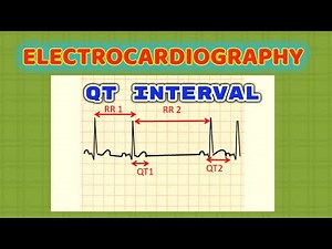 Electrocardiography QT Interval. A Brief discussion on QT interval and its significance