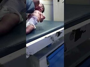 How to Pass NG Tube for Secretion | Step-by-Step Nasogastric Tube Suction Guide