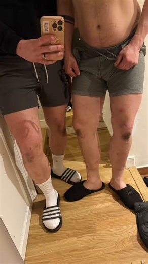 Dirty knees season is BACK 😈doubletrouble is out again hunting for dick 🫶🏼🌳👯‍♂️ find us at the cruising spots #gaycruisingbefore: after: