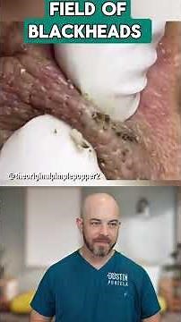 Dermatologist Explains Favre-Racouchot Syndrome and Sun Damage