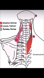 AnatomyLinks CLINICAL 🔗 - Neck and Upper Back Pain Differentiating muscles and other tissues in the body is complex as everything in living anatomy is LINKED. However, a detailed understanding of biomechanics and tissue architecture can help orient one’s self throughout the body much like a compass. In this case, neck pain around C2-3 or upper back pain can be from a multitude of problems but it is helpful to consider the physiological motions available and this will point to muscles which init