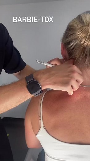 Introducing Trap-Tox, injections placed into the trapezius muscle. This can help relax the muscles reducing tension in the shoulders as well as elongating and slimming the neck. #traptox #babrbietox #injectables | Martina Collins Dental & Skin Clinic