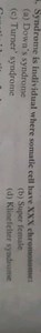 Syndrome is individual where somatic cell have XXX chromosome:... | Filo