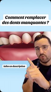 3.3K views · 2.7K reactions | Implants postérieurs : une solution...