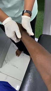 Un jour avec un Kinésithérapeute Épisode 2 – Rééducation de la main #kinesitherapie #kine #Reeducation #main #massage #mobilisation #douleurs #santé #rehabilitation | Kinésithérapie : Soins et Conseils