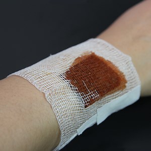 [Hot Item] High Absorbency 100% Cotton Gauze Sponge/ Swab/ Pad