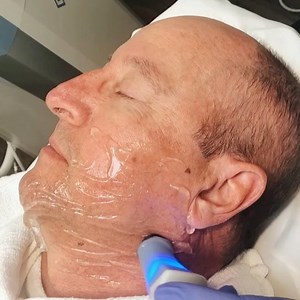 With Exilis, we are able to contour and tighten the lower face and neck with ZERO downtime or surgery👏🏼 ⠀⠀⠀⠀⠀⠀⠀⠀⠀ ⠀⠀⠀⠀⠀⠀⠀⠀⠀ Exilis utilizes radiofrequency technology to deliver deep, thermal heat that remodels collagen and tightens the skin. In as little as 4 treatments, the skin appears tighter and more contoured. ⠀⠀⠀⠀⠀⠀⠀⠀⠀ ⠀⠀⠀⠀⠀⠀⠀⠀⠀ Call or text 225-927-7546 to schedule your consultation or appointment today📞 ⠀⠀⠀⠀⠀⠀⠀⠀⠀ ⠀⠀⠀⠀⠀⠀⠀⠀⠀ • • • ⠀⠀⠀⠀⠀⠀⠀⠀⠀ 📍BATON ROUGE & GONZALES #wcc #williamsoncosme