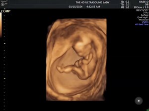 not even 14 weeks yet and this babe is full of kicks! #13weeks5days #3ounces | The 4D Ultrasound Lady