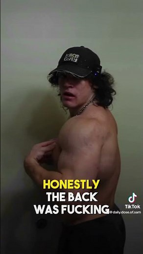 Sam Sulek on his acne transformation #gym #samsulek #acnetreatment