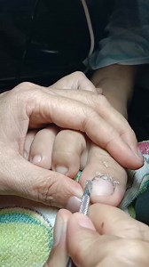 Toenails cleaning #everyonehighlights #nonfollowers #nonfollowersviewers #fbreels #viralpost2025シ # #everyone #toenailscleaning Part 4 | Juvy Paloso Magallano