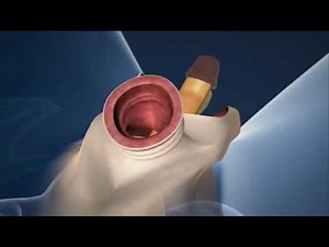 The Imperfect Man - Male to Female surgical transformation 3D Animation (Season5 Ep27)