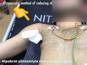 Hipokrat Yöntemiyle Omuz Redüksiyonu/Hippocratic Method Of Reducing Shoulder Dislocation