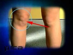 Inside And Outside Knee Pain