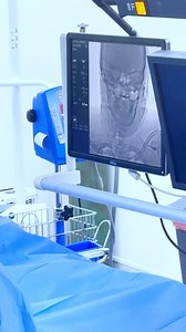 Target Organ Delivery Of Adult Stem Cell Therapy To The Brain. #asct #adultstemcelltherapynigeria | Glory Wellness & Regenerative Centre | Facebook