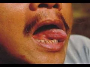 Free Lecture-Dr. Jaime Dy-Liacco