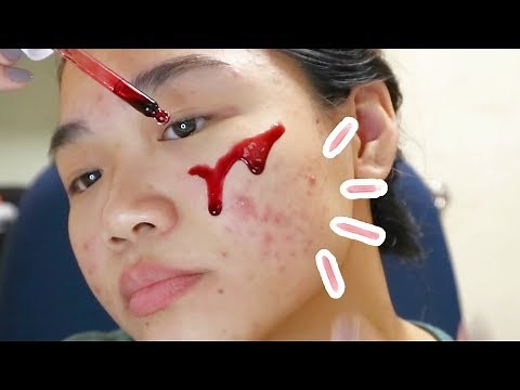 The ordinary peeling solution review (4 weeks)