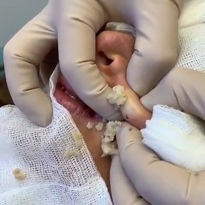 Ouch 😬 , Boom | Elsin Asco