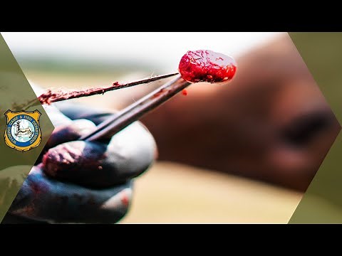 Lymph Node Removal for CWD Sampling