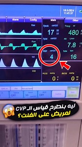 141K views · 1.9K reactions | ليه بنطرح قياس الـ CVP لمريض على الفنت؟...