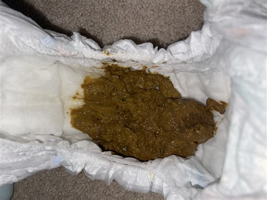 Pooping my baby pampers