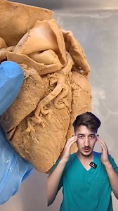 Stiai ca emotiile intense pot afecta inima? 👨‍⚕️#studentlamedicina #informatiimedicale #invatamimpreuna #medic #inima #inimafranta #takotsubo #despartire #divort | Doctor Madalin