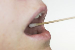 What are mouth ulcers and what causes them?