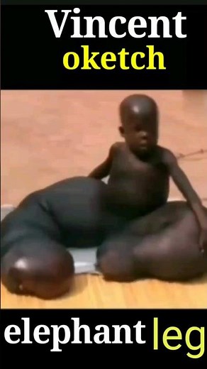 elephant legs boy | Vincent oketch Uganda # world studt