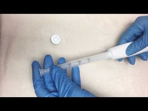 How to Use an Intravaginal Medication Part 2: Tube & Applicator Technique