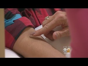 Lisa Sigell's Health Watch (March 3)