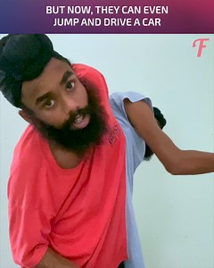 Inspiring story of conjoined twins (For entertainment purposes only. Consult professionals if guidance on activities is presented. No brand affiliation is implied if any are shown. If inspired by true events, creative adaptations may be included. Content may include public footage.) | Fabiosa Philippines