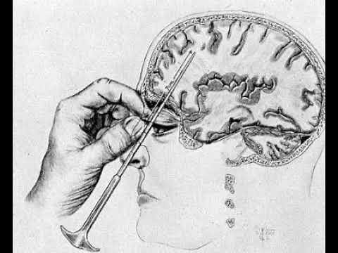 Evolution of Schizophrenia Treatment
