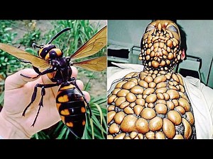Here's What Happens After Being Bitten by Venomous Insects