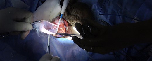 Scrotal Hydrocelectomy Made Simple During a Surgical Mission | Journal of Medical Insight