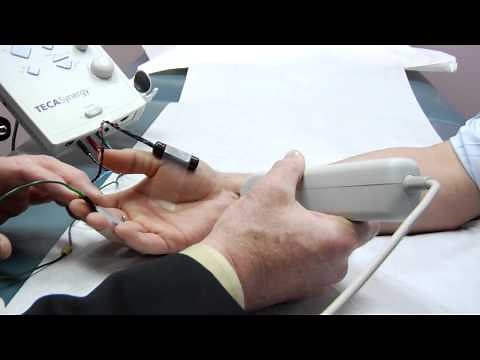 EMG - How to Test for Pinched Nerves