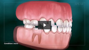 Ankylosis - Cosmetic Dentistry
