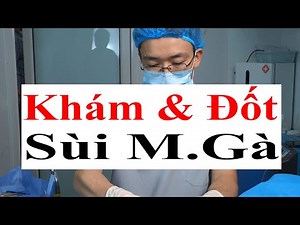 Cách Nhận Biết Sùi Mào Gà Điển Hình & Đốt Sùi Mào Gà Bằng Dao Điện | Bác Sĩ Sắc