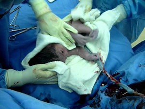 5 VALORAR EL APGAR AL MINUTO