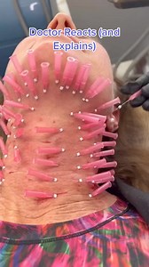 Should you go through this to improve collagen in your skin? 🫢 #collagen #threading #collagenstimulation | Dr. Anthony Youn