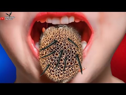 ASMR removal trypophobia Maggots Worm infected mouth & tounge|ASMR Animation Tritment 2D Clean Worms