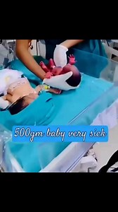 Baby was born 500gm | The birth room