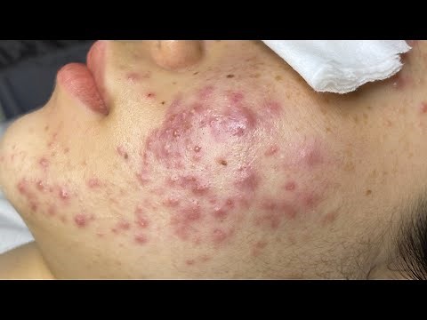 Relax with Linh My Dang Spa - Ms. Thuong Part 1 - #byMyAnhDang 18