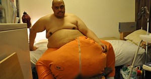 Life With A 132 Pound Scrotum