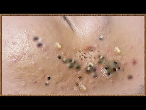 تلميع وتنظيف الجلد الطبيعي المدور # 8162