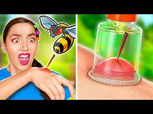 30+ BEACH HACKS & CAMPING HACKS FOR SUMMER || I Got Stung by A Bee by BadaBOOM!