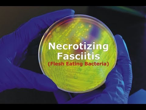 Necrotizing Fasciitis - Flesh Eating Bacteria